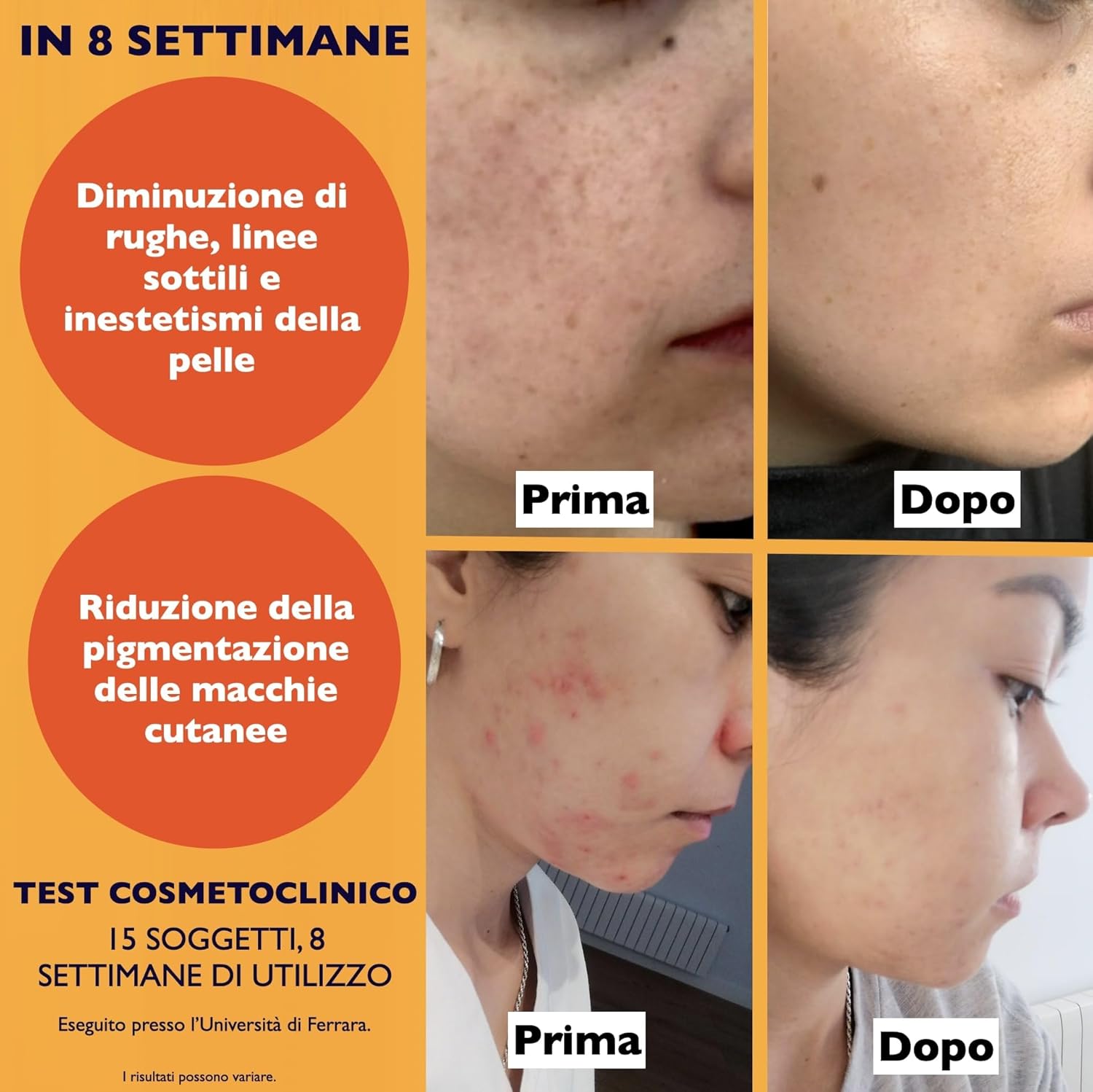 60ml. Bio Siero Vitamina C e Vit. E. Siero Viso Acido Ialuronico Antirughe, Antimacchie Illuminante, e Antietà. Ideale Come Crema Contorno Occhi e per Dermaroller. Biologico,Vegano