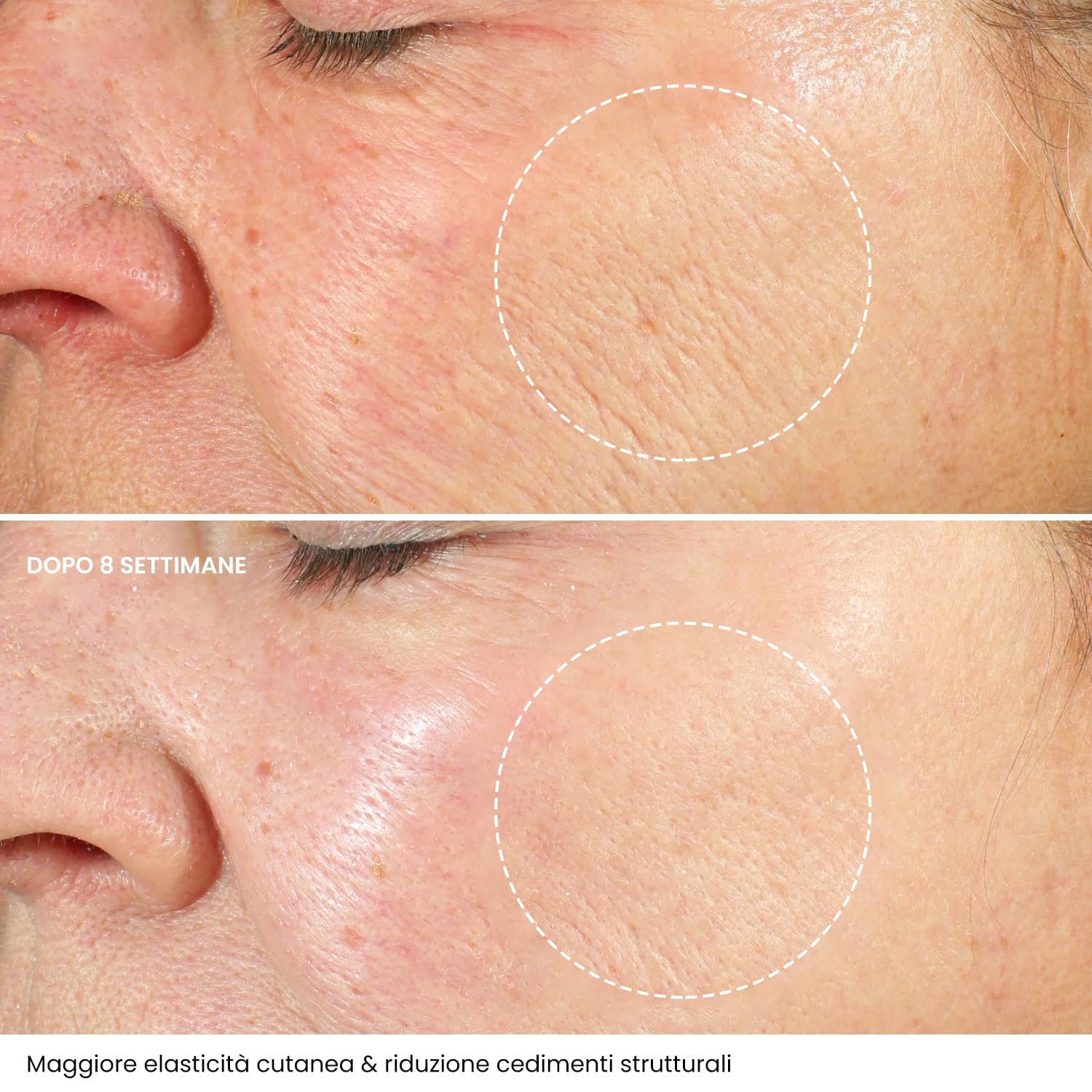 Crema Viso Antirughe Acido ialuronico con Retinolo e Collagene - Eletta Miglior Crema Antirughe Donna e Uomo per Rughe, Macchie Scure e Linee Sottili - 50ml