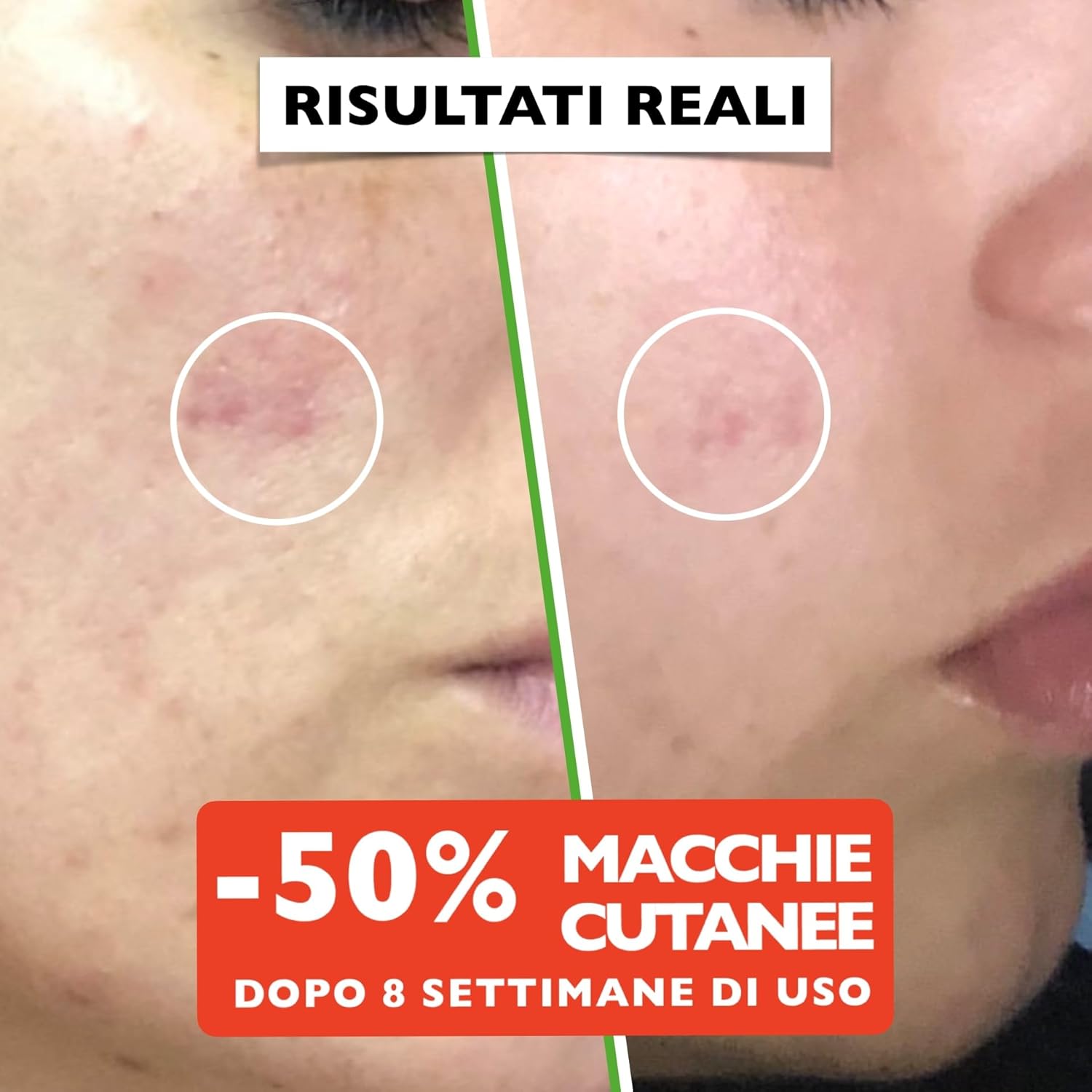 60ml. Bio Siero Vitamina C e Vit. E. Siero Viso Acido Ialuronico Antirughe, Antimacchie Illuminante, e Antietà. Ideale Come Crema Contorno Occhi e per Dermaroller. Biologico,Vegano